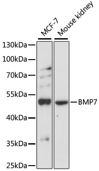 Western blot - BMP7 Polyclonal Antibody 