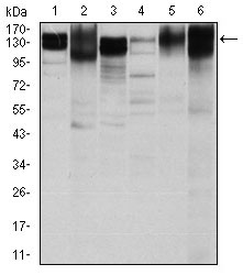 Western blot analysis using ITGB1 mouse mAb against Hela (1), HepG2 (2), A549 (3), Jurkat(4), L1210 (5) and Cos7 (6) cell lysate.