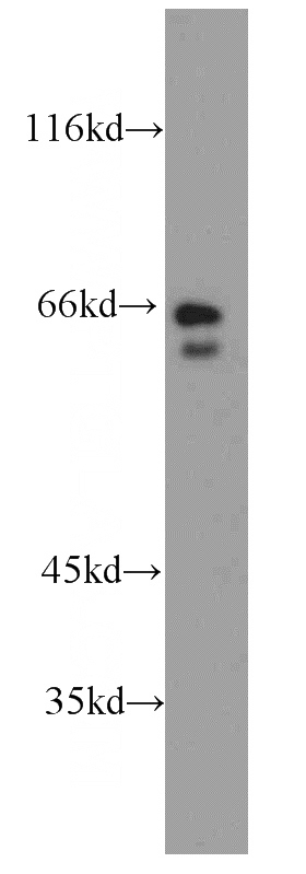 human brain tissue were subjected to SDS PAGE followed by western blot with Catalog No:114699(RIC8B antibody) at dilution of 1:1000