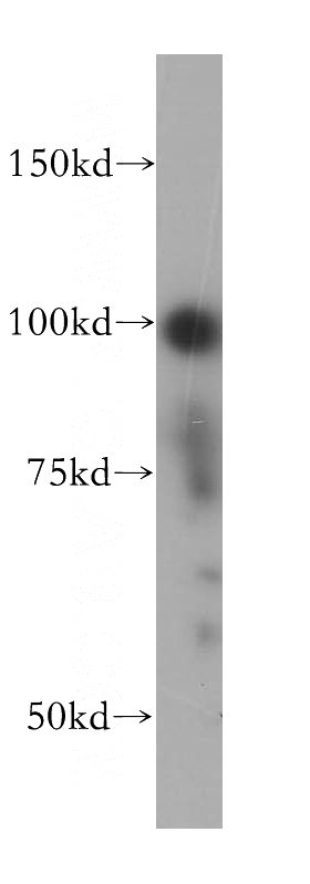 MCF7 cells were subjected to SDS PAGE followed by western blot with Catalog No:108134(ANAPC2 antibody) at dilution of 1:500
