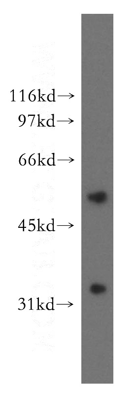 human liver tissue were subjected to SDS PAGE followed by western blot with Catalog No:107946(AKR7A3 antibody) at dilution of 1:400