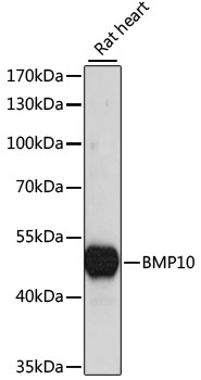 Western blot - BMP10 Polyclonal Antibody 