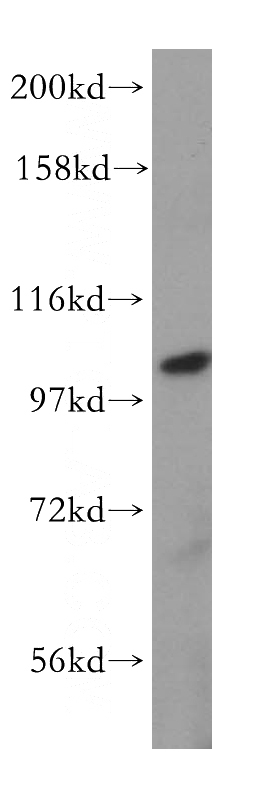 SH-SY5Y cells were subjected to SDS PAGE followed by western blot with Catalog No:112907(MVP antibody) at dilution of 1:500