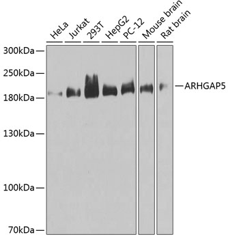 Western blot - ARHGAP5 Polyclonal Antibody 