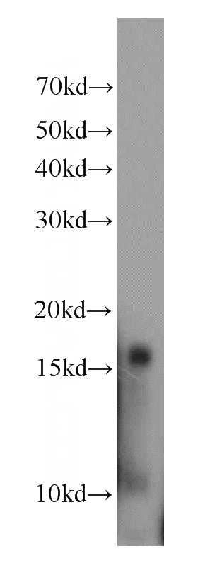 human blood tissue were subjected to SDS PAGE followed by western blot with Catalog No:111267(HBD antibody) at dilution of 1:1000