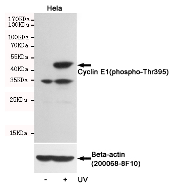 Western blot detection of Cyclin E1(phospho-Thr395) in Hela cells untreated or treated with UV using Cyclin E1(phospho-Thr395) Rabbit pAb (dilution 1:500, upper) or u03b2-Actin Mouse mAb (200068-8F10, lower).Predicted band size:48kDa.Observed band size:48kDa.