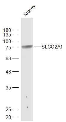 Fig1: Sample:; Kidney (Mouse) Lysate at 40 ug; Primary: Anti-SLCO2A1 at 1/1000 dilution; Secondary: IRDye800CW Goat Anti-Rabbit IgG at 1/20000 dilution; Predicted band size: 70 kD; Observed band size: 75 kD