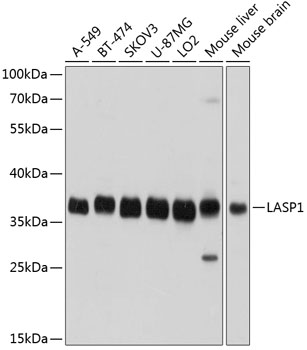 Western blot - LASP1 Polyclonal Antibody 