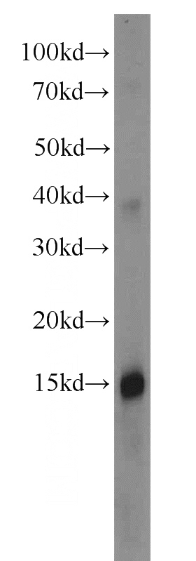 human serum tissue were subjected to SDS PAGE followed by western blot with Catalog No:108036(APOA2 antibody) at dilution of 1:1000