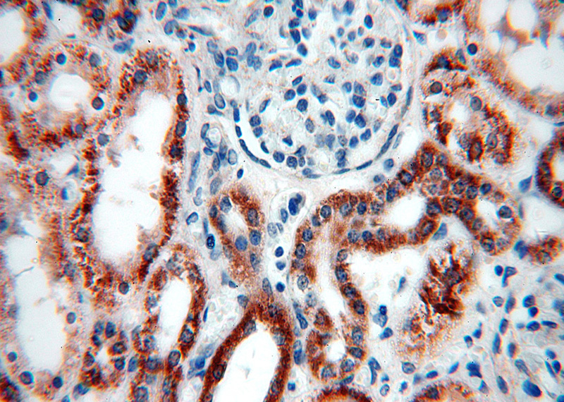 Immunohistochemical of paraffin-embedded human kidney using Catalog No:107721(ACADS antibody) at dilution of 1:100 (under 40x lens)
