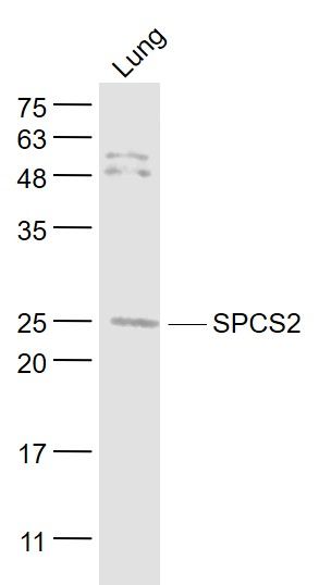 Fig1: Sample:; Lung (Mouse) Lysate at 40 ug; Primary: Anti- SPCS2 at 1/300 dilution; Secondary: IRDye800CW Goat Anti-Rabbit IgG at 1/20000 dilution; Predicted band size: 25 kD; Observed band size: 25 kD