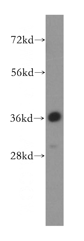 HeLa cells were subjected to SDS PAGE followed by western blot with Catalog No:108557(BXDC1 antibody) at dilution of 1:500