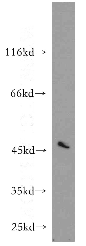 MCF7 cells were subjected to SDS PAGE followed by western blot with Catalog No:114872(RUNDC3B antibody) at dilution of 1:500