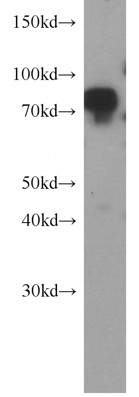 HeLa cells were subjected to SDS PAGE followed by western blot with Catalog No:111054(GOLM1 antibody) at dilution of 1:1500