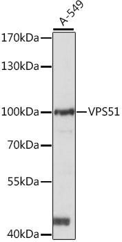 Western blot - VPS51 Polyclonal Antibody 