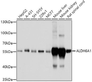 Western blot - ALDH6A1 Polyclonal Antibody 