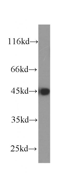 human testis tissue were subjected to SDS PAGE followed by western blot with Catalog No:107411(MAGEA3 antibody) at dilution of 1:1000
