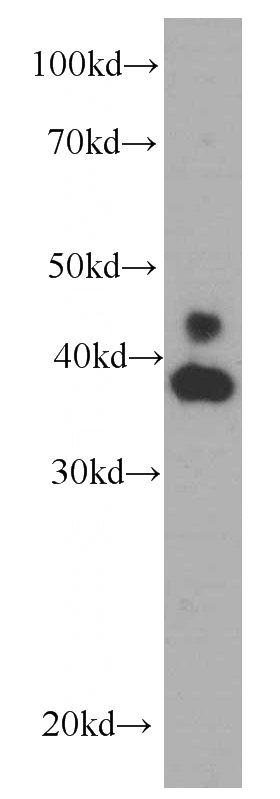 HeLa cells were subjected to SDS PAGE followed by western blot with Catalog No:107194(ERK1/2 Antibody) at dilution of 1:1000