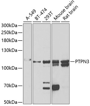 Western blot - PTPN3 Polyclonal Antibody 