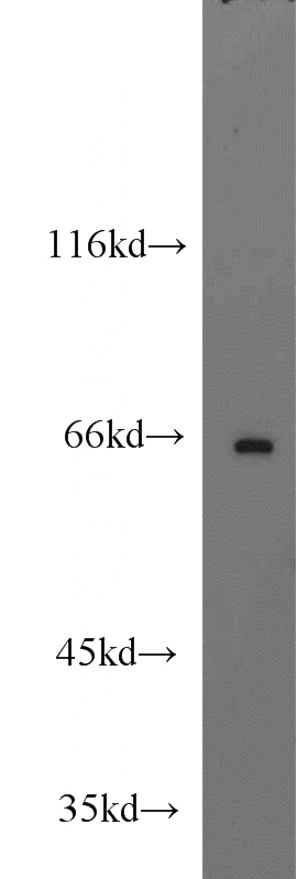 mouse testis tissue were subjected to SDS PAGE followed by western blot with Catalog No:115632(ST7L antibody) at dilution of 1:1500
