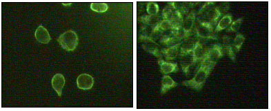 Immunofluorescence staining of methanol-fixed A431 (left) and Hela (right) cells showing cytoplasmic and membrane localization.