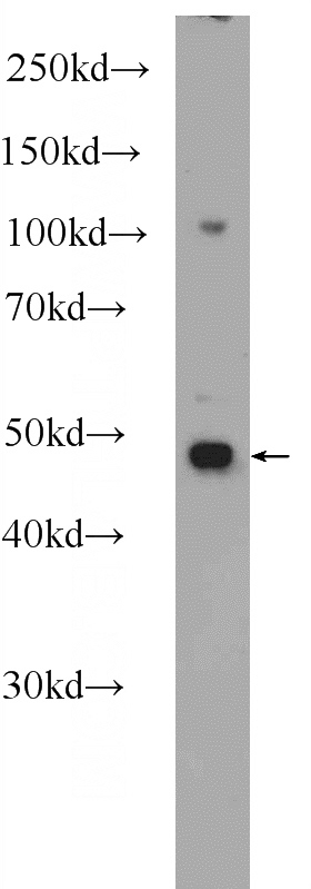 HeLa cells were subjected to SDS PAGE followed by western blot with Catalog No:114339(PURA Antibody) at dilution of 1:1000