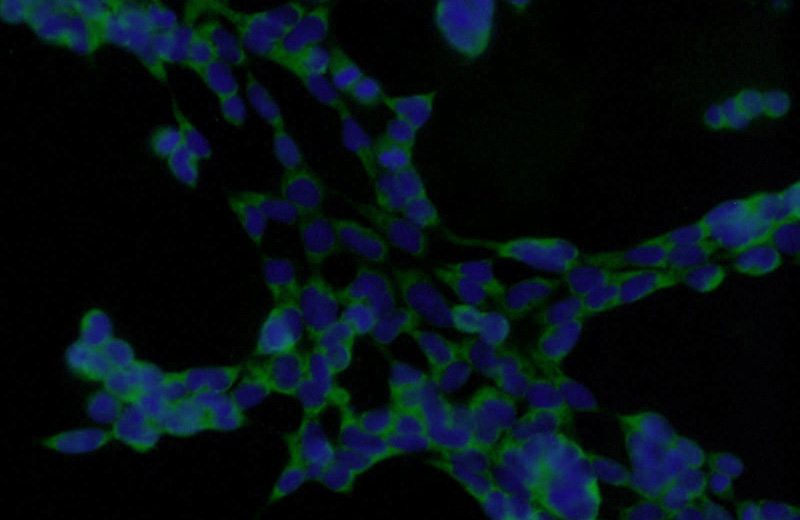 Immunofluorescent analysis of HEK-293 cells using Catalog No:109890(DENR Antibody) at dilution of 1:25 and Alexa Fluor 488-congugated AffiniPure Goat Anti-Rabbit IgG(H+L)