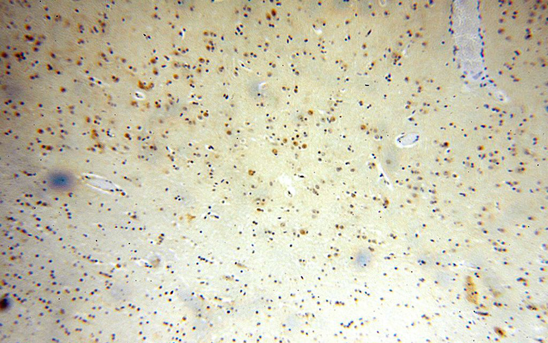 Immunohistochemical of paraffin-embedded human brain using Catalog No:116954(ZNF18 antibody) at dilution of 1:50 (under 10x lens)