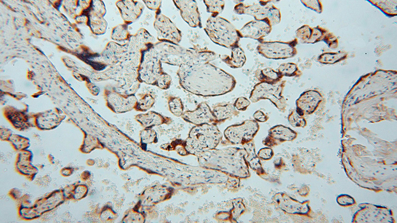 Immunohistochemical of paraffin-embedded human placenta using Catalog No:113622(PDIA5 antibody) at dilution of 1:100 (under 10x lens)