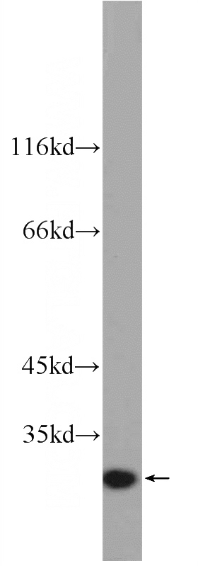 Recombinant protein were subjected to SDS PAGE followed by western blot with Catalog No:111748(IL6 Antibody) at dilution of 1:3000