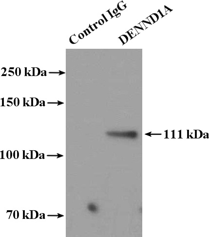 IP Result of anti-DENND1A (IP:Catalog No:109888, 4ug; Detection:Catalog No:109888 1:600) with K-562 cells lysate 3200ug.