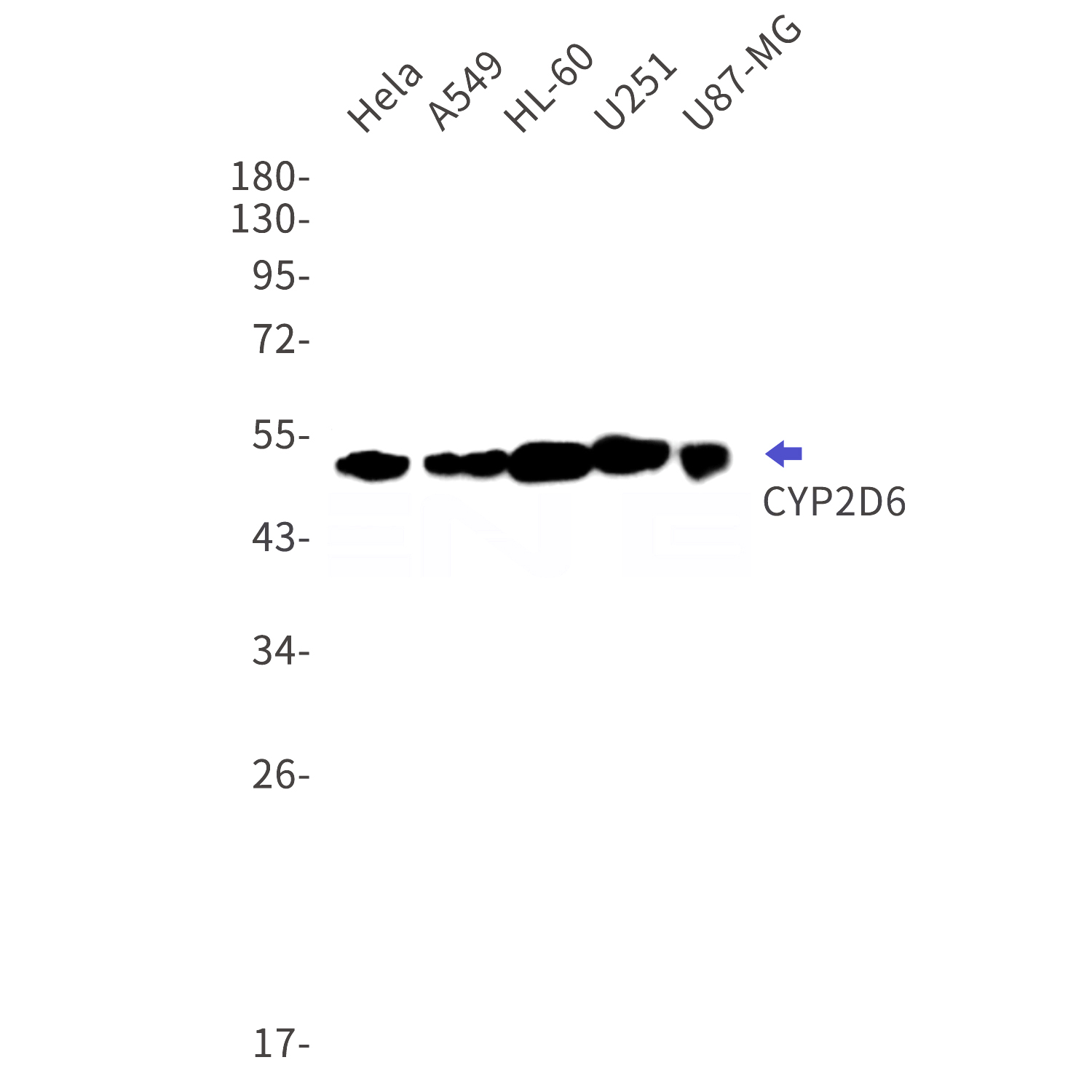 Western blot detection of CYP2D6 in Hela,A549,HL-60,U251,U87-MG cell lysates using CYP2D6 Rabbit mAb(1:1000 diluted).Predicted band size:56kDa.Observed band size:50kDa.