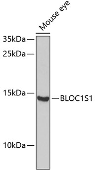 Western blot - BLOC1S1 Polyclonal Antibody 