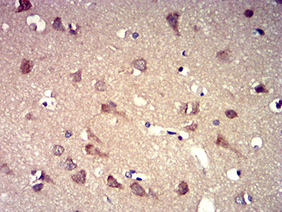 Fig5: Immunohistochemical analysis of paraffin-embedded brain tissue using anti-P2RY8 antibody. The section was pre-treated using heat mediated antigen retrieval with Tris-EDTA buffer (pH 8.0) for 20 minutes. The tissues were blocked in 5% BSA for 30 minutes at room temperature, washed with ddH2O and PBS, and then probed with the primary antibody ( 1/100) for 30 minutes at room temperature. The detection was performed using an HRP conjugated compact polymer system. DAB was used as the chromogen. Tissues were counterstained with hematoxylin and mounted with DPX.