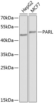 Western blot - PARL Polyclonal Antibody 