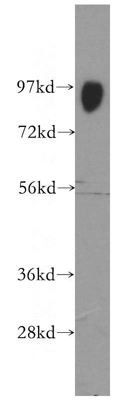 human brain tissue were subjected to SDS PAGE followed by western blot with Catalog No:115507(SORT1 antibody) at dilution of 1:1200