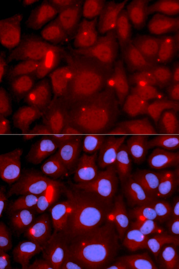 Immunofluorescence - PADI4 Polyclonal Antibody 