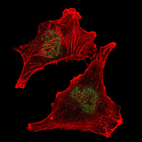 Immunofluorescence analysis of U251 cells using SUZ12 mouse mAb (green). Red: Actin filaments have been labeled with Alexa Fluor-555 phalloidin.