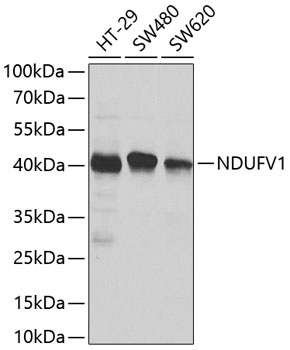 Western blot - NDUFV1 Polyclonal Antibody 