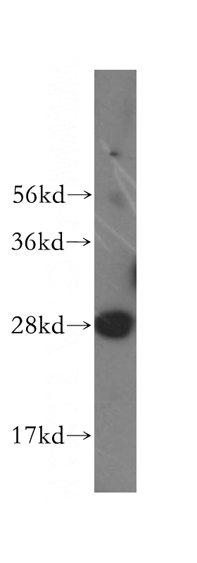 human liver tissue were subjected to SDS PAGE followed by western blot with Catalog No:111164(GS28 antibody) at dilution of 1:500