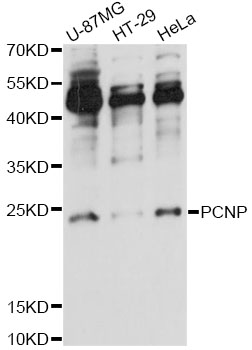 Western blot - PCNP Polyclonal Antibody 
