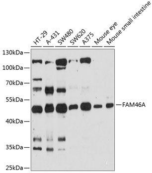 Western blot - FAM46A Polyclonal Antibody 
