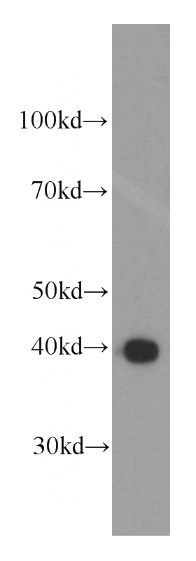 Recombinant protein were subjected to SDS PAGE followed by western blot with Catalog No:117330(MBP-Tag antibody) at dilution of 1:4000