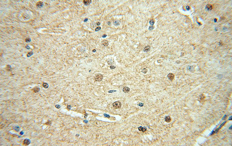 Immunohistochemical of paraffin-embedded human brain using Catalog No:115009(SCNM1 antibody) at dilution of 1:50 (under 40x lens)