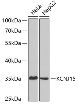 Western blot - KCNJ15 Polyclonal Antibody 