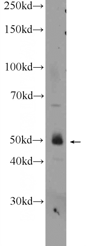 SW 1990 cells were subjected to SDS PAGE followed by western blot with Catalog No:116829(WIPI1 Antibody) at dilution of 1:1000