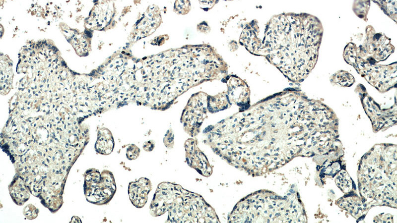 Immunohistochemical of paraffin-embedded human placenta using Catalog No:110600(FAM76A antibody) at dilution of 1:50 (under 10x lens)
