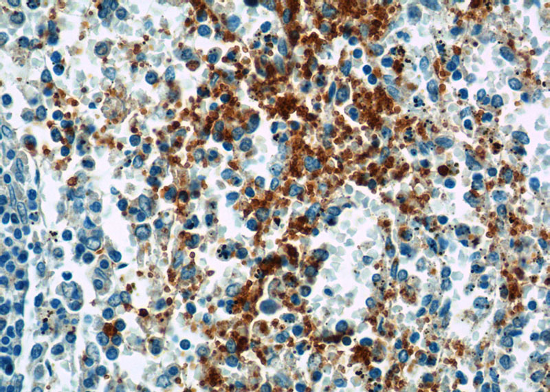 Immunohistochemistry of paraffin-embedded human spleen tissue slide using Catalog No:111055(GP9 Antibody) at dilution of 1:50 (under 40x lens)