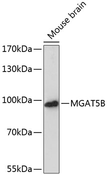 Western blot - MGAT5B Polyclonal Antibody 