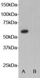 Fig1: Western blot analysis on 293 cell (A) transfected and (B) none transfected with AIRE gene using anti-AIRE polyclonal antibody.
